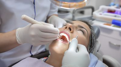Mexican dentist carefully applying composite resin to American patient's tooth during bonding procedure